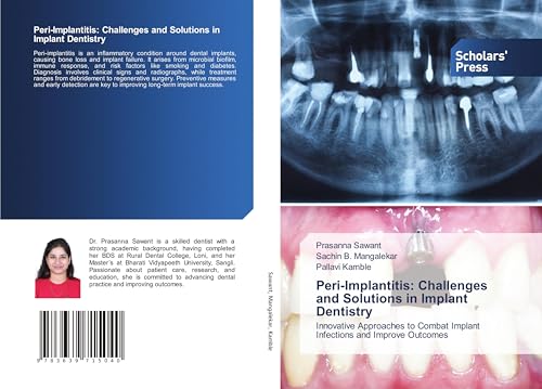 Peri-Implantitis: Challenges and Solutions in Implant Dentistry: Innovative Approaches to Combat Implant Infections and Improve Outcomes von VDM Verlag