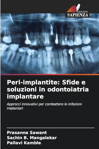 Peri-implantite: Sfide e soluzioni in odontoiatria implantare: Approcci innovativi per combattere le infezioni implantari von Edizioni Sapienza