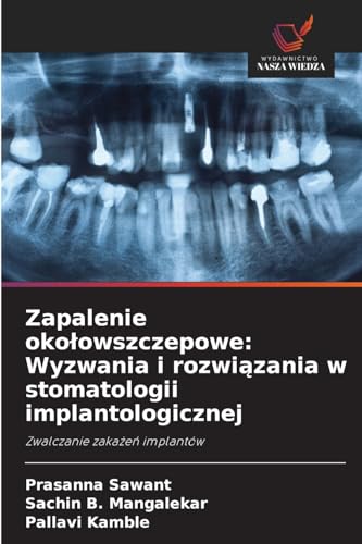 Zapalenie okołowszczepowe: Wyzwania i rozwiązania w stomatologii implantologicznej: Zwalczanie zakażeń implantów: Zwalczanie zakazen implantów von Wydawnictwo Nasza Wiedza