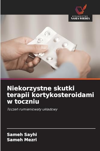 Niekorzystne skutki terapii kortykosteroidami w toczniu: Tocze¿ rumieniowaty uk¿adowy von Wydawnictwo Nasza Wiedza