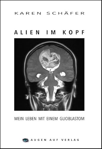 Alien im Kopf: Mein Leben mit einem Glioblastom von Augen Auf Verlag