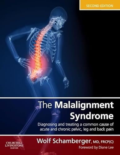 The Malalignment Syndrome: diagnosis and treatment of common pelvic and back pain