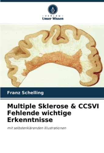 Multiple Sklerose & CCSVI Fehlende wichtige Erkenntnisse: mit selbsterklärenden Illustrationen von Verlag Unser Wissen