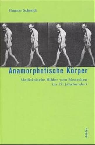 Anamorphotische Körper. Medizinische Bilder vom Menschen im 19. Jahrhundert