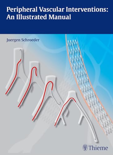 Peripheral Vascular Interventions: An Illustrated Manual von Thieme Medical Publishers