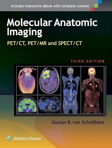 Clinical Molecular Anatomic Imaging: PET/CT, PET/MR and SPECT/CT. Inlcudes interactive eBook with complete content