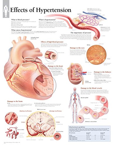 Effects of Hypertension Paper Poster