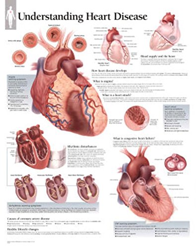 Understanding Heart Disease Laminated Poster