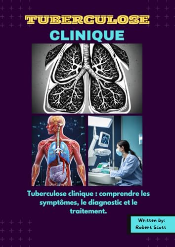 Tuberculose clinique: Tuberculose clinique : comprendre les symptômes, le diagnostic et le traitement. von Independently published