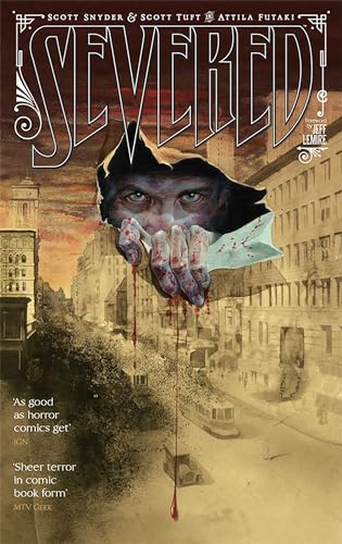 Severed Severed