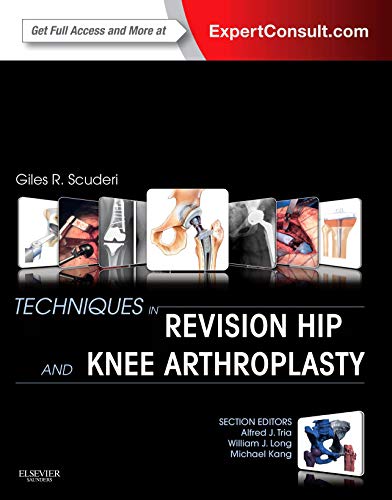 Techniques in Revision Hip and Knee Arthroplasty: Expert Consult: Online and Print von Saunders