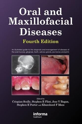 Oral and Maxillofacial Diseases: An Illustrated Guide to the Diagnosis and Management of Diseases of the Oral Mucosa, Gingivae, Teeth, Salivary Glands, Jaw Bones and Joints Oral and Maxillofacial Diseases: An Illustrated Guide to the Diagnosis and Management of Diseases of the Oral Mucosa, Gingivae, Teeth, Salivary Glands, Jaw Bones and Joints