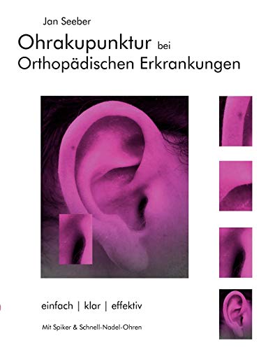 Ohrakupunktur bei Orthopädischen Erkrankungen: Balancierte Ohrakupunktur: einfach, klar, effektiv Ohrakupunktur bei Orthopädischen Erkrankungen: Balancierte Ohrakupunktur: einfach, klar, effektiv