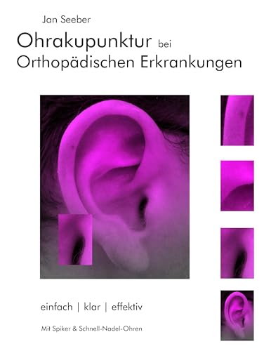 Ohrakupunktur bei Orthopädischen Erkrankungen: Balancierte Ohrakupunktur: einfach, klar, effektiv von Books on Demand GmbH