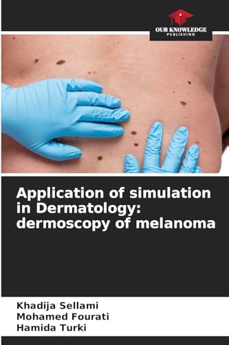 Application of simulation in Dermatology: dermoscopy of melanoma: DE von Our Knowledge Publishing