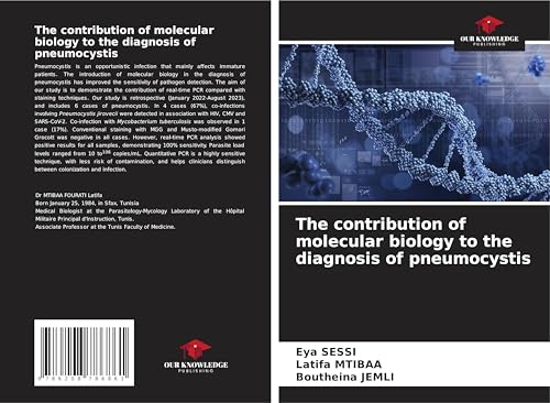 The contribution of molecular biology to the diagnosis of pneumocystis: DE von Our Knowledge Publishing