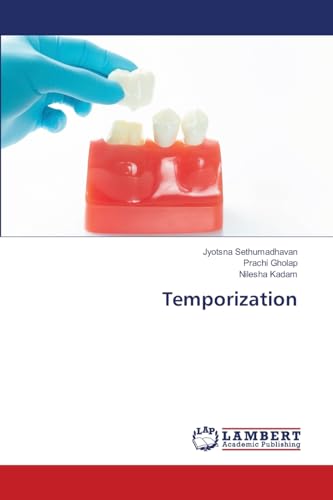 Temporization: DE von LAP LAMBERT Academic Publishing