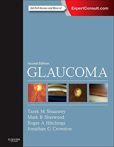 Glaucoma: 2-Volume Set von Saunders Ltd.
