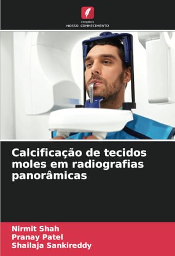 Calcificação de tecidos moles em radiografias panorâmicas von Edições Nosso Conhecimento