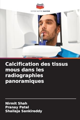 Calcification des tissus mous dans les radiographies panoramiques von Editions Notre Savoir