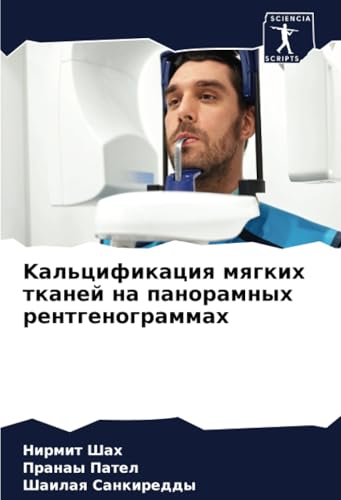 Kальцификация мягких тканей на панорамных рентгенограммах: DE von Sciencia Scripts