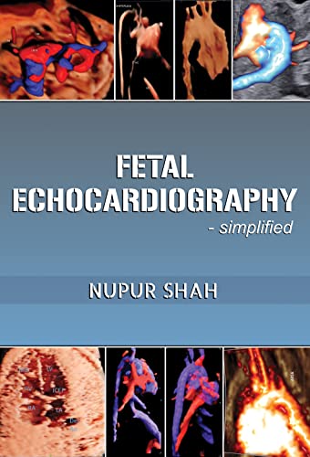 Fetal Echocardiography - Simplified Fetal Echocardiography - Simplified von White Falcon Publishing