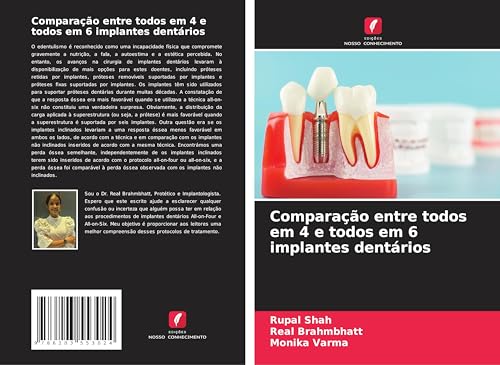 Comparação entre todos em 4 e todos em 6 implantes dentários