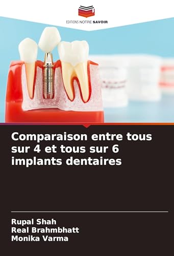 Comparaison entre tous sur 4 et tous sur 6 implants dentaires von Editions Notre Savoir