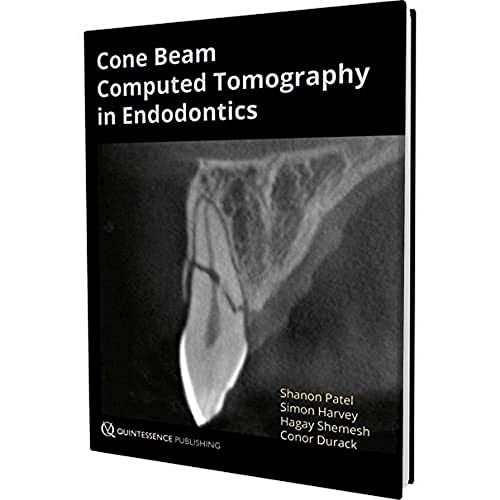Cone Beam Computed Tomography in Endodontics von Quintessence Publishing