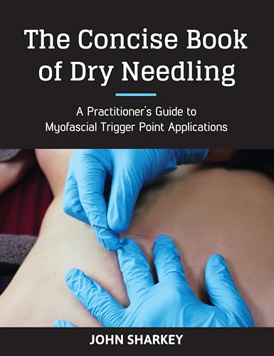 The Concise Book of Dry Needling: A Practitioner's Guide to Myofascial Trigger Point Applications The Concise Book of Dry Needling: A Practitioner's Guide to Myofascial Trigger Point Applications