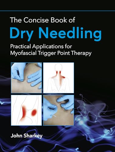 The Concise Book of Dry Needling: A Practitioner's Guide to Myofascial Trigger Point Applications: Practical Applications for Myofascial Trigger Point Therapy von Lotus Publishing