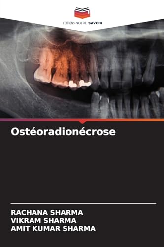 Ostéoradionécrose: DE