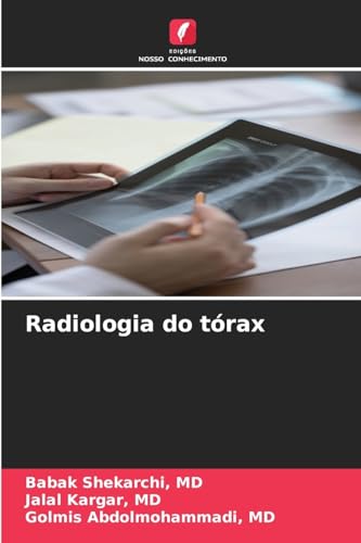 Radiologia do tórax: DE von Edições Nosso Conhecimento