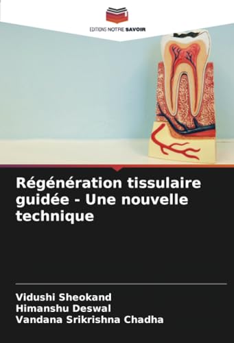 Régénération tissulaire guidée - Une nouvelle technique: DE von Editions Notre Savoir