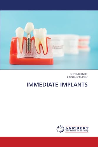 IMMEDIATE IMPLANTS: DE von LAP LAMBERT Academic Publishing