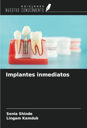 Implantes inmediatos von Ediciones Nuestro Conocimiento