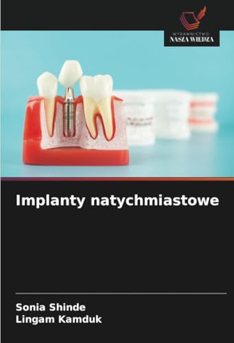 Implanty natychmiastowe: DE von Wydawnictwo Nasza Wiedza