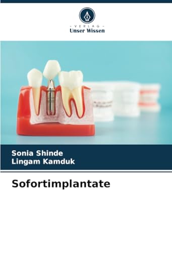 Sofortimplantate: DE von Verlag Unser Wissen