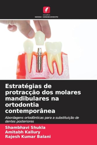 Estratégias de protracção dos molares mandibulares na ortodontia contemporânea: Abordagens ortodônticas para a substituição de dentes posteriores von Edições Nosso Conhecimento