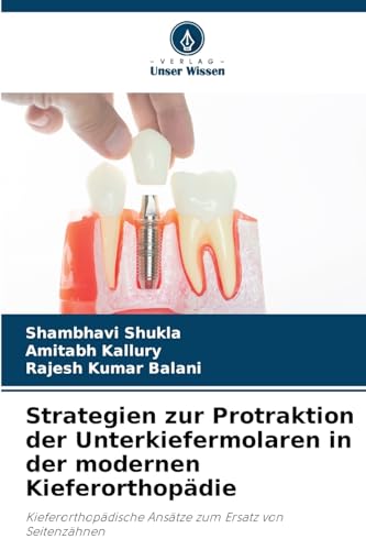 Strategien zur Protraktion der Unterkiefermolaren in der modernen Kieferorthopädie: Kieferorthopädische Ansätze zum Ersatz von Seitenzähnen Strategien zur Protraktion der Unterkiefermolaren in der modernen Kieferorthopädie: Kieferorthopädische Ansätze zum Ersatz von Seitenzähnen von Verlag Unser Wissen