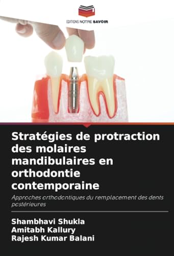 Stratégies de protraction des molaires mandibulaires en orthodontie contemporaine: Approches orthodontiques du remplacement des dents postérieures von Editions Notre Savoir