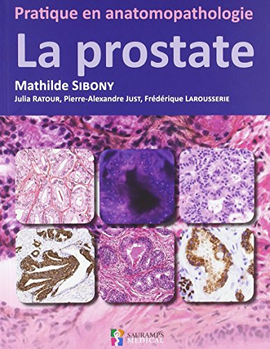 La Prostate - Pratique En Anatomopathologie