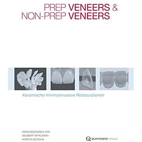 Prep Veneers und Non-Prep Veneers: Keramische minimal-invasive Restaurationen
