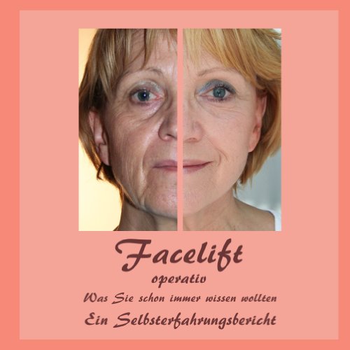 Facelift operativ: Was Sie schon immer wissen wollten Ein Selbsterfahrungsbericht