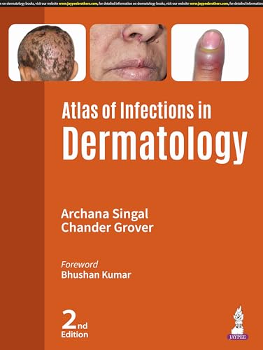 Atlas of Infections in Dermatology von Jaypee Brothers Medical Publishers