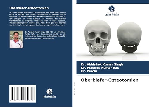 Oberkiefer-Osteotomien: DE von Verlag Unser Wissen