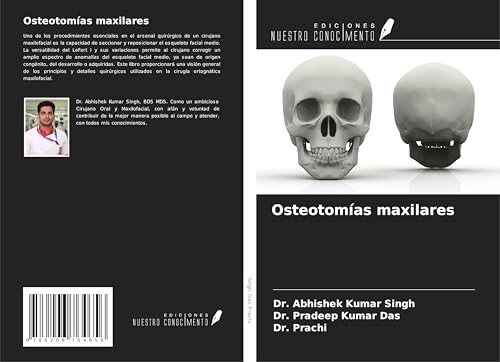 Osteotomías maxilares von Ediciones Nuestro Conocimiento