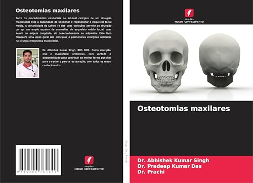 Osteotomias maxilares: DE von Edições Nosso Conhecimento