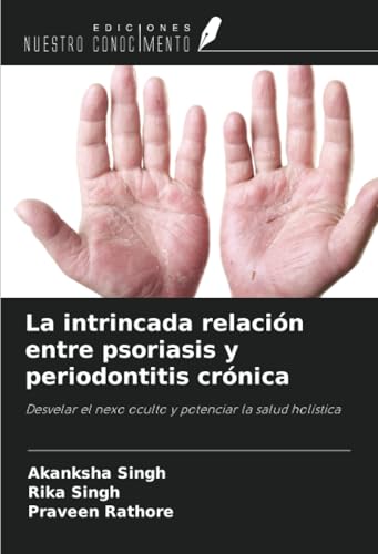 La intrincada relación entre psoriasis y periodontitis crónica: Desvelar el nexo oculto y potenciar la salud holística von Ediciones Nuestro Conocimiento
