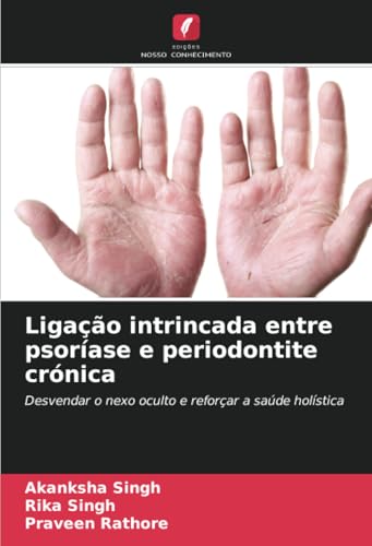 Ligação intrincada entre psoríase e periodontite crónica: Desvendar o nexo oculto e reforçar a saúde holística von Edições Nosso Conhecimento
